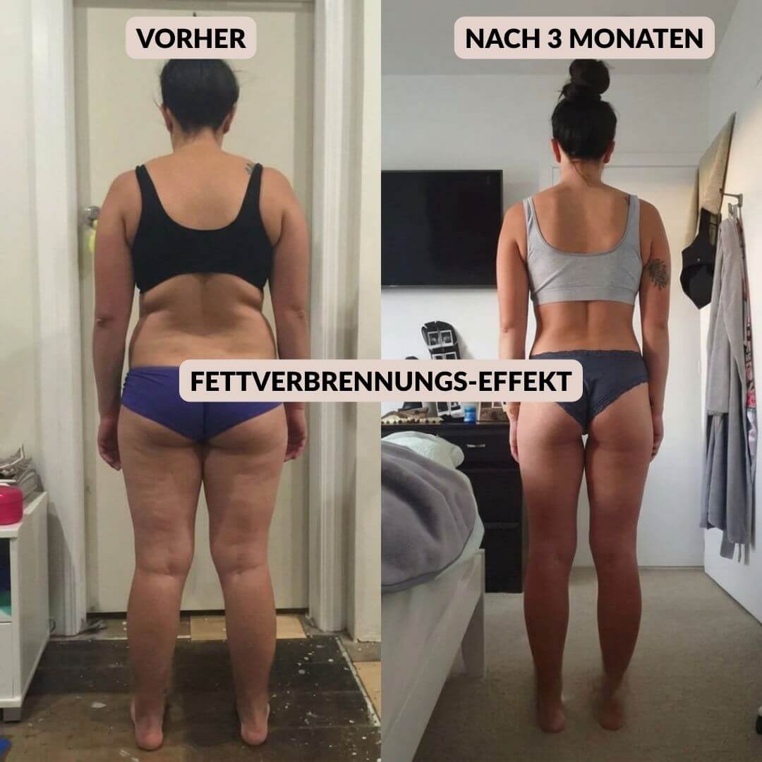 Anti Cellulite Leggings