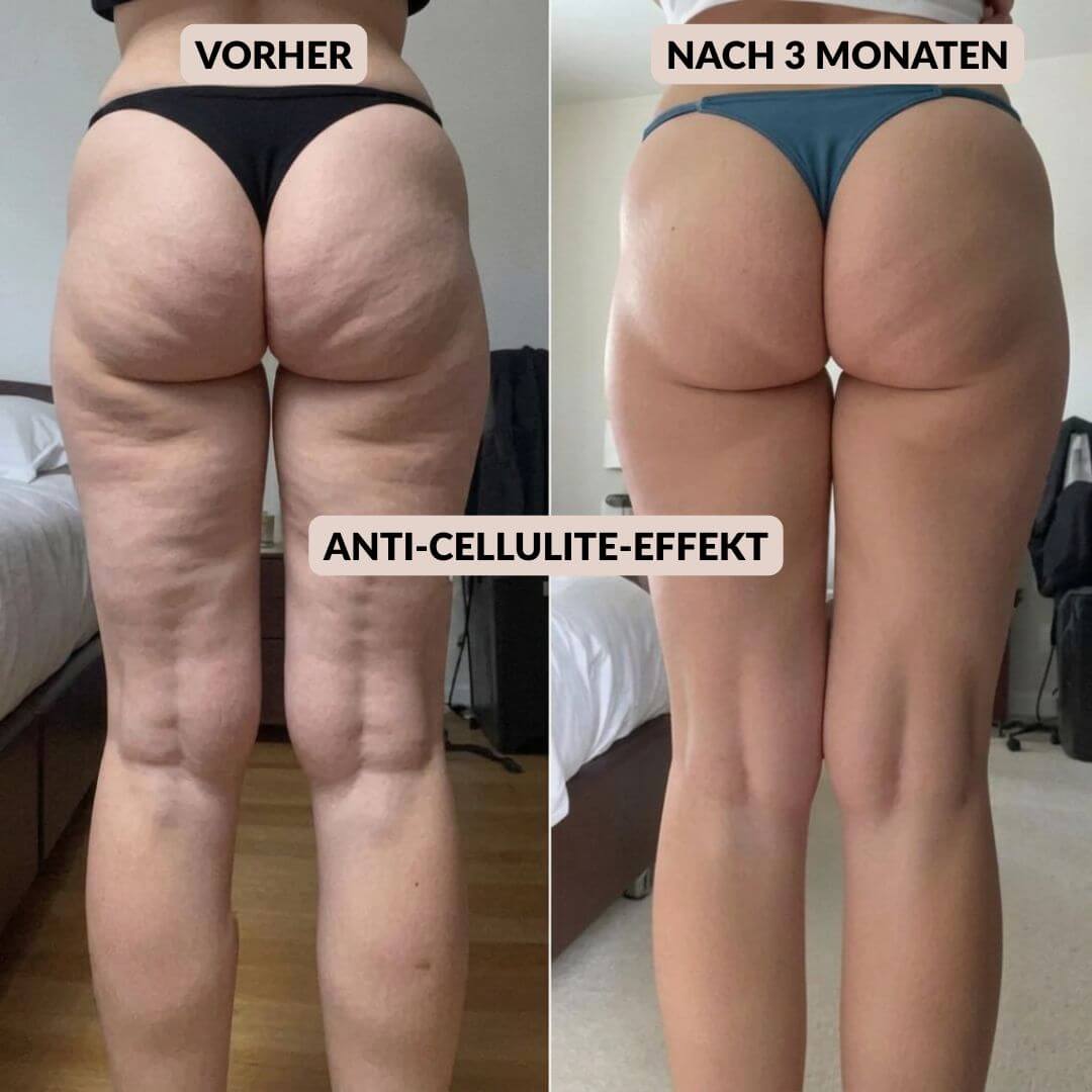 Anti Cellulite Leggings