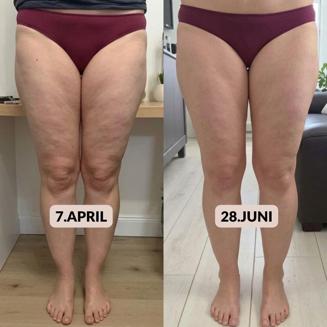 Anti Cellulite Leggings